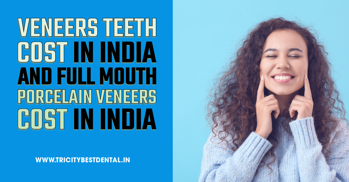 Veneers Teeth Cost in India and Full Mouth Porcelain Veneers Cost in India