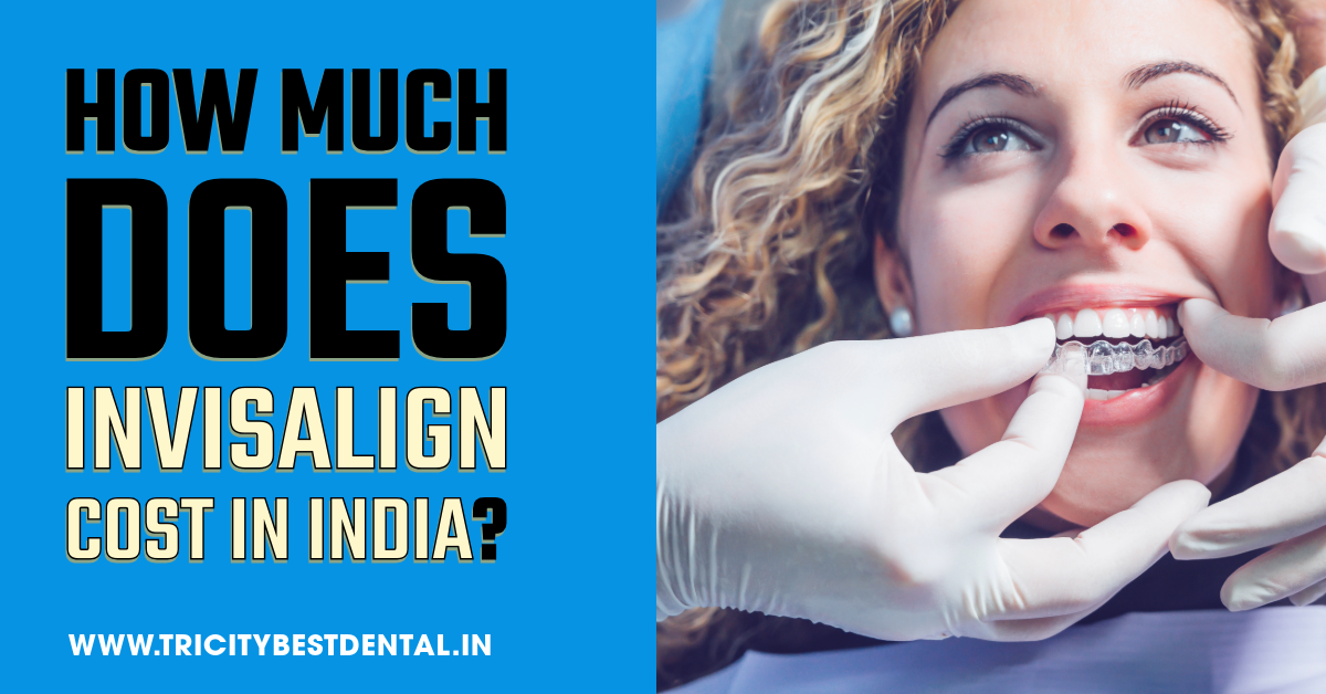 How Much Does Invisalign Cost in India