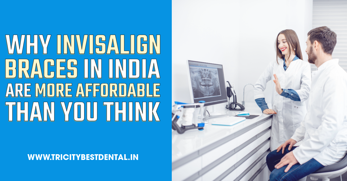 Why Invisalign Braces in India Are More Affordable Than You Think