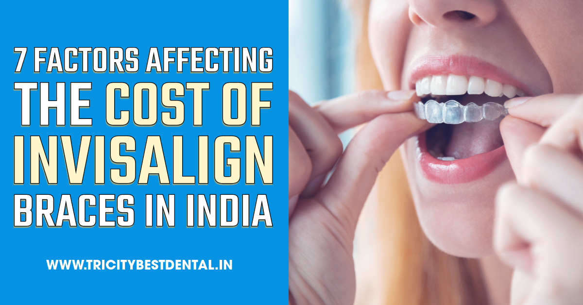 7 Factors Affecting the Cost of Invisalign Braces in India