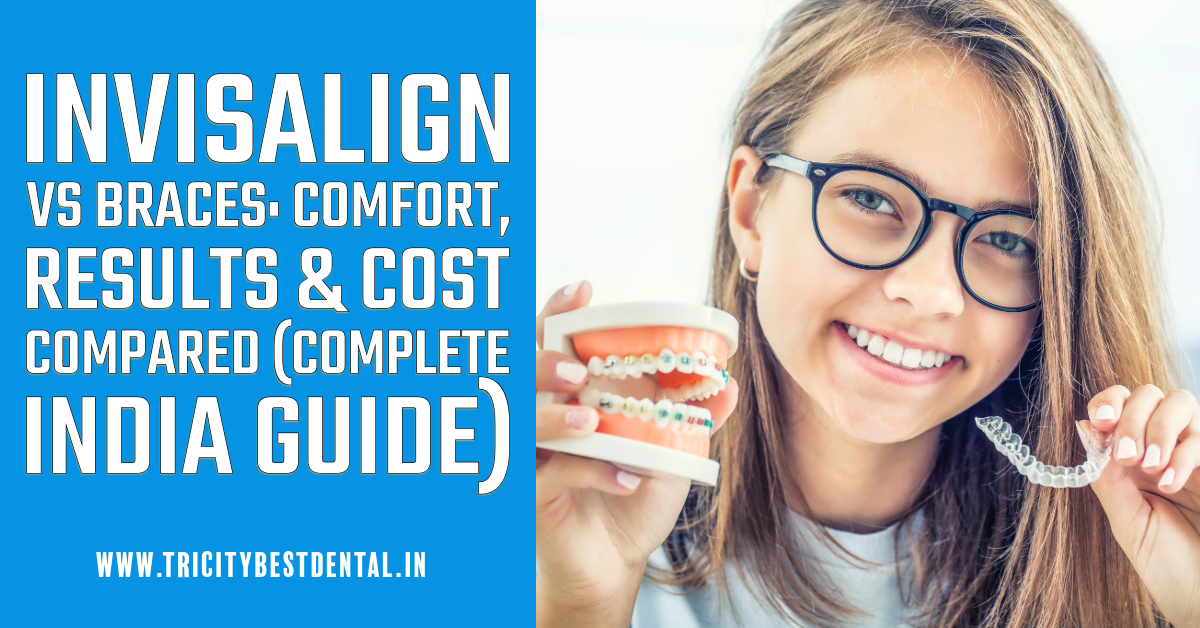 Invisalign vs Braces-complete india guide