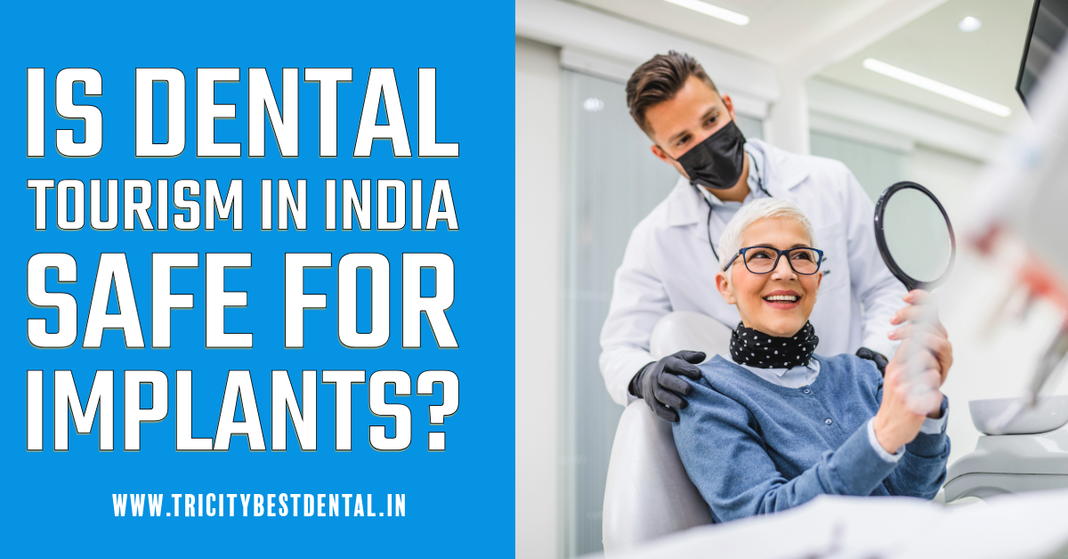 Is Dental Tourism in India Safe for Implants