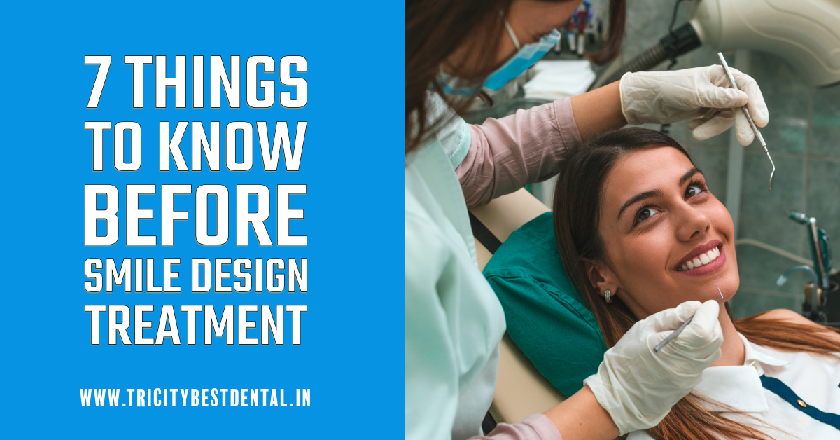 7 Things to Know Before Smile Design Treatment