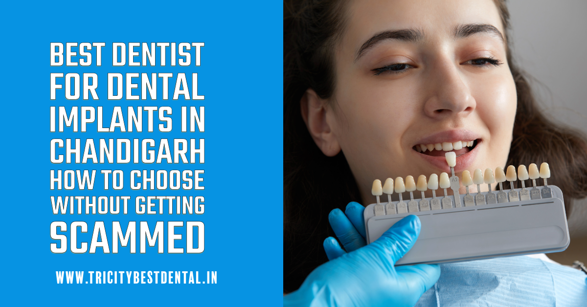 Best Dentist for Dental Implants in Chandigarh How to Choose Without Getting Scammed