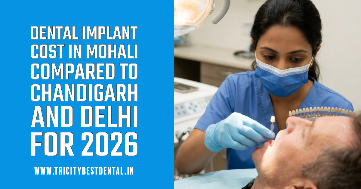 Dental Implant Cost in Mohali Compared to Chandigarh and Delhi for 2026