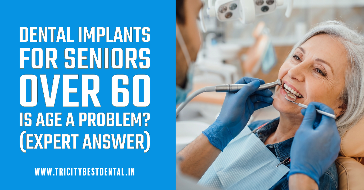 Dental Implants for Seniors Over 60 Is Age a Problem (Expert Answer)