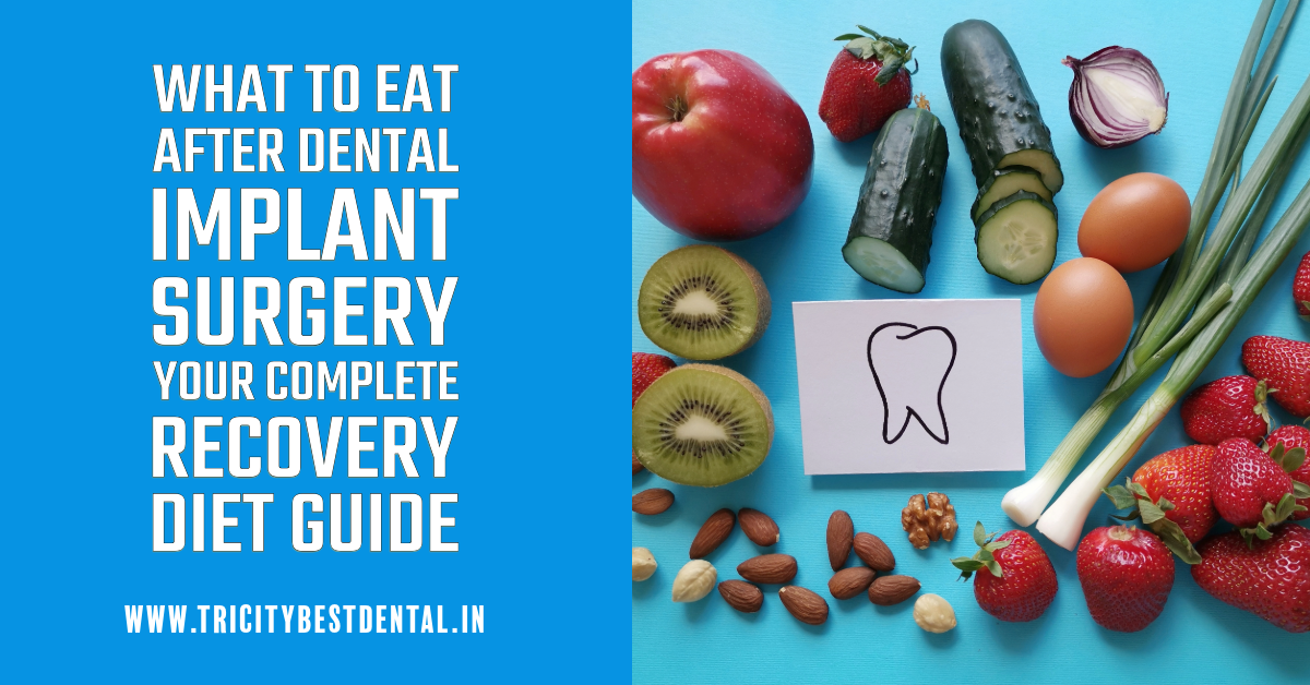 What to Eat After Dental Implant Surgery Your Complete Recovery Diet Guide