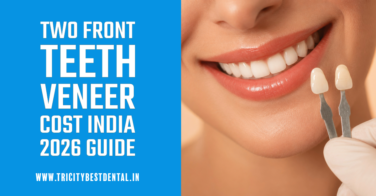 Two Front Teeth Veneers Cost 2026 | Mohali Guide | Perfect Teeth