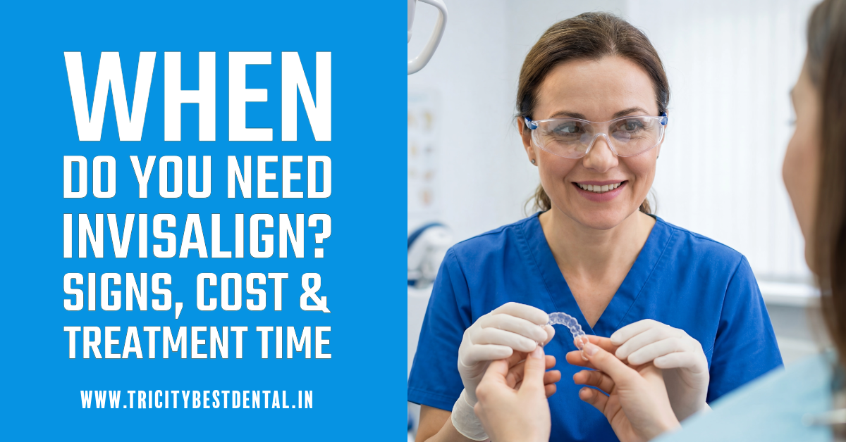 When Do You Need Invisalign Signs, Cost & Treatment Time