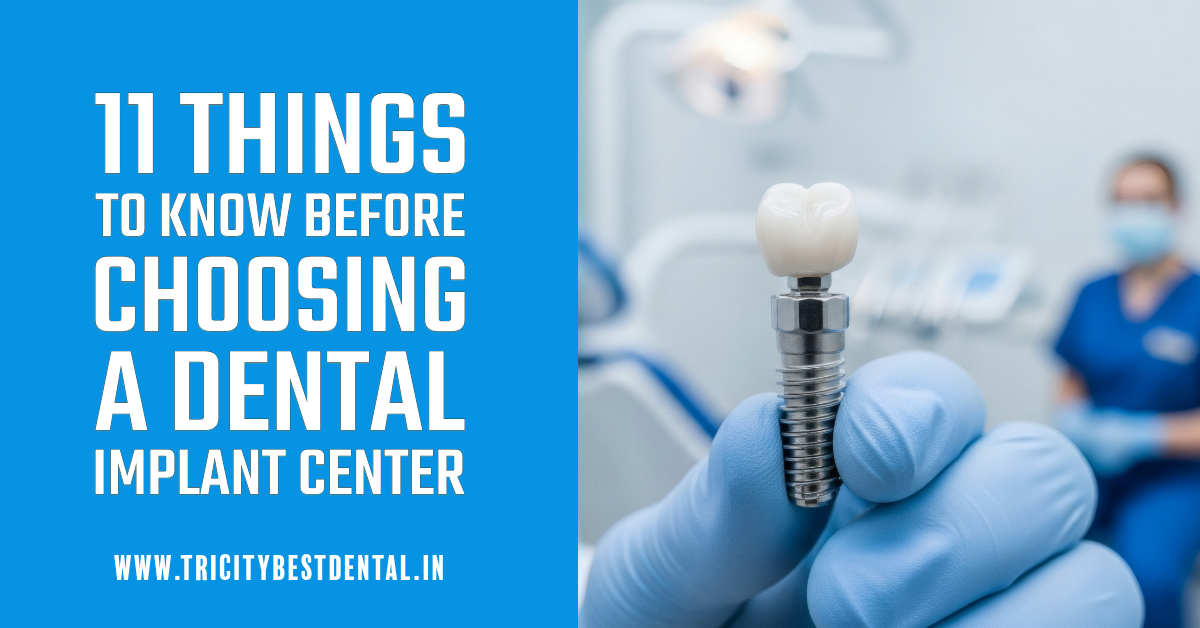 11 Things to Know Before Choosing a Dental Implant Center
